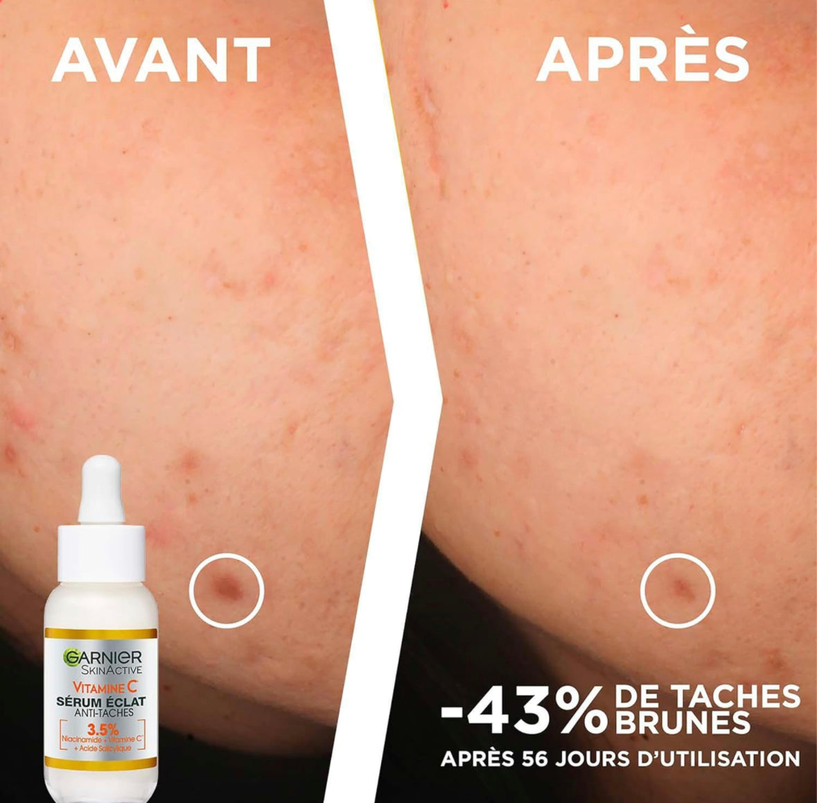 Garnier - Sérum Jour Anti-Taches Brunes 30 ml